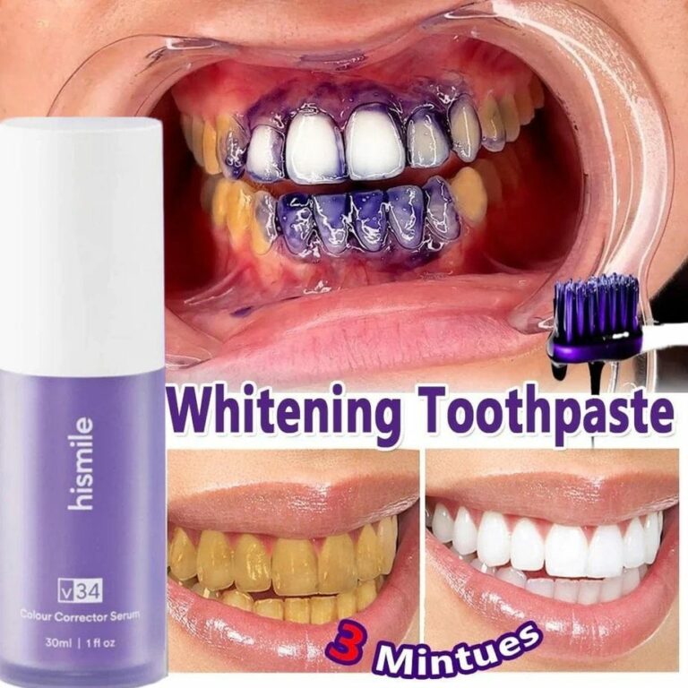 Hismile V34 Teeth Whitening Color Corrector Serum | Instant Brightening Solution 30ml - Image 2